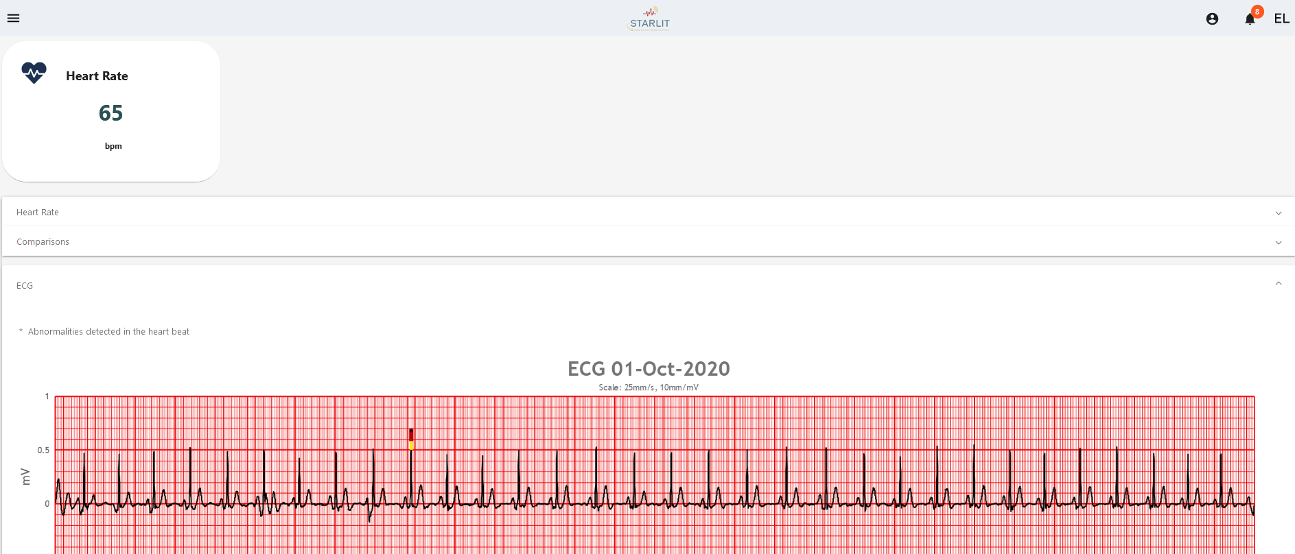 Electrocardiogram